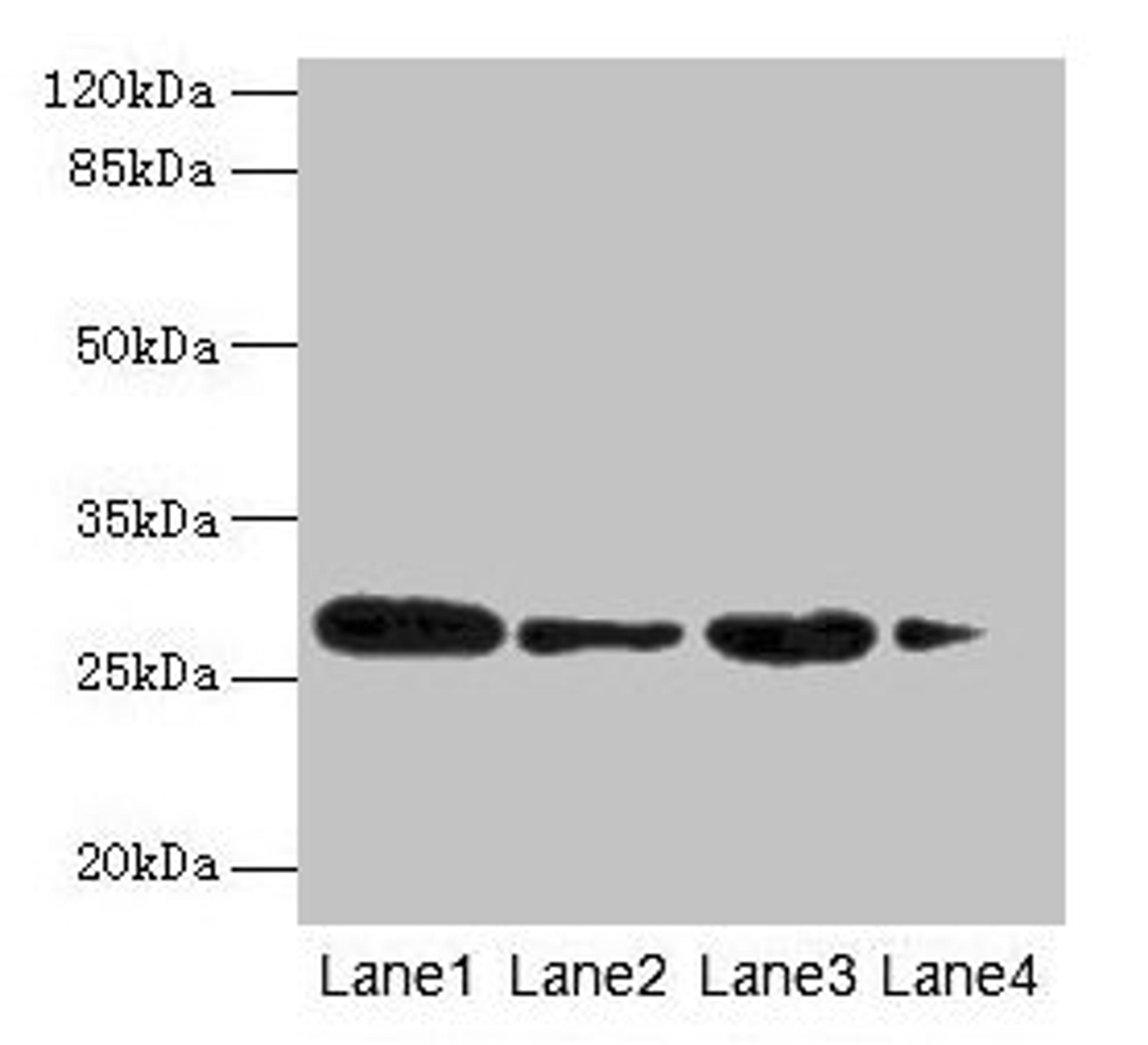 Western blot. All lanes: MED7 antibody at 6µg/ml. Lane 1: Jurkat whole cell lysate. Lane 2: Hela whole cell lysate. Lane 3: Mouse thymus tissue. Lane 4: NIH/3T3 whole cell lysate. Secondary. Goat polyclonal to rabbit IgG at 1/10000 dilution. Predicted band size: 28 kDa. Observed band size: 28 kDa