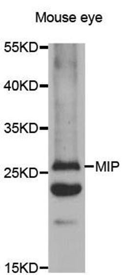 Western blot analysis of extracts of mouse eyes tissue lysate using MIP antibody