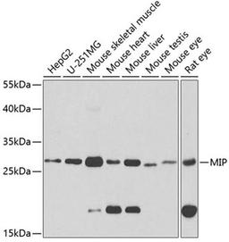 Western blot - MIP antibody (A2886)