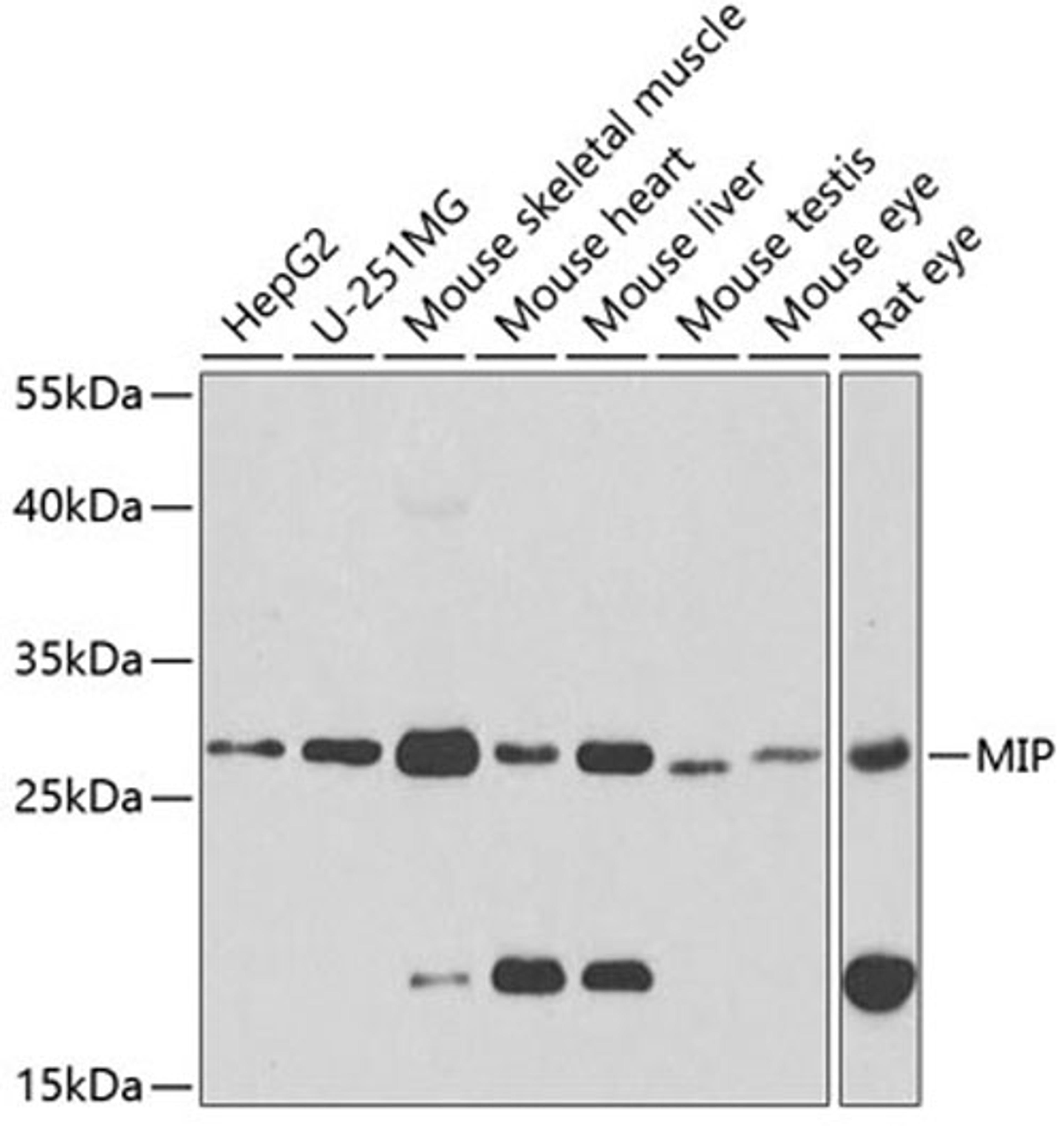 Western blot - MIP antibody (A2886)