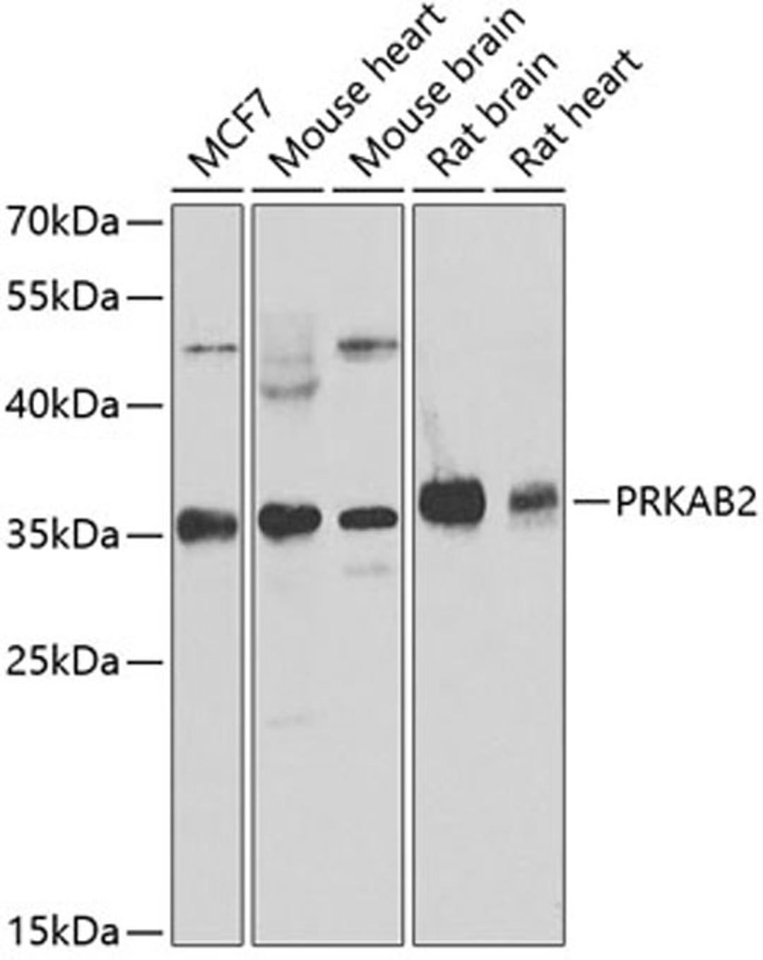 Western blot - PRKAB2 antibody (A6952)