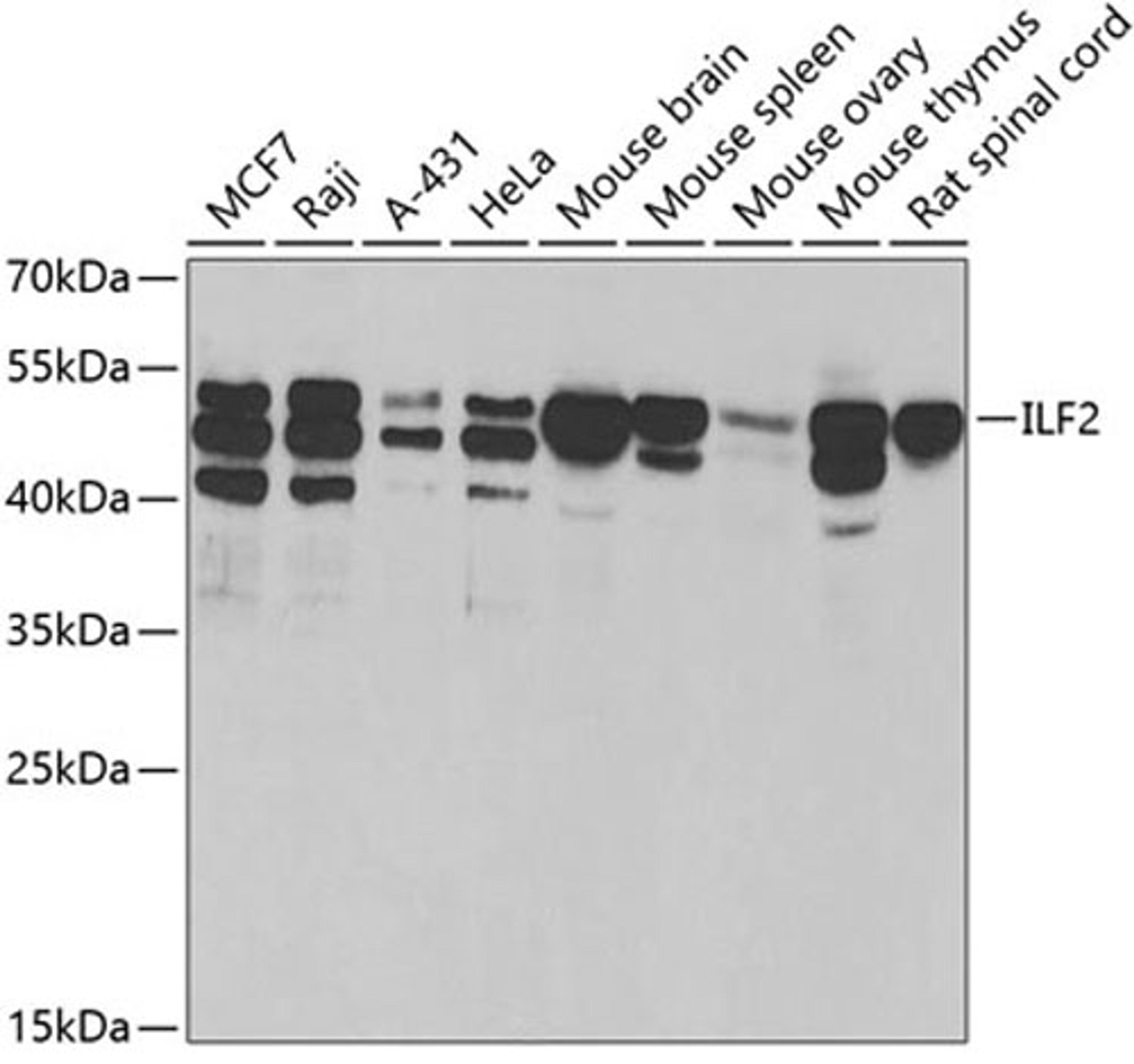 Western blot - ILF2 antibody (A5882)