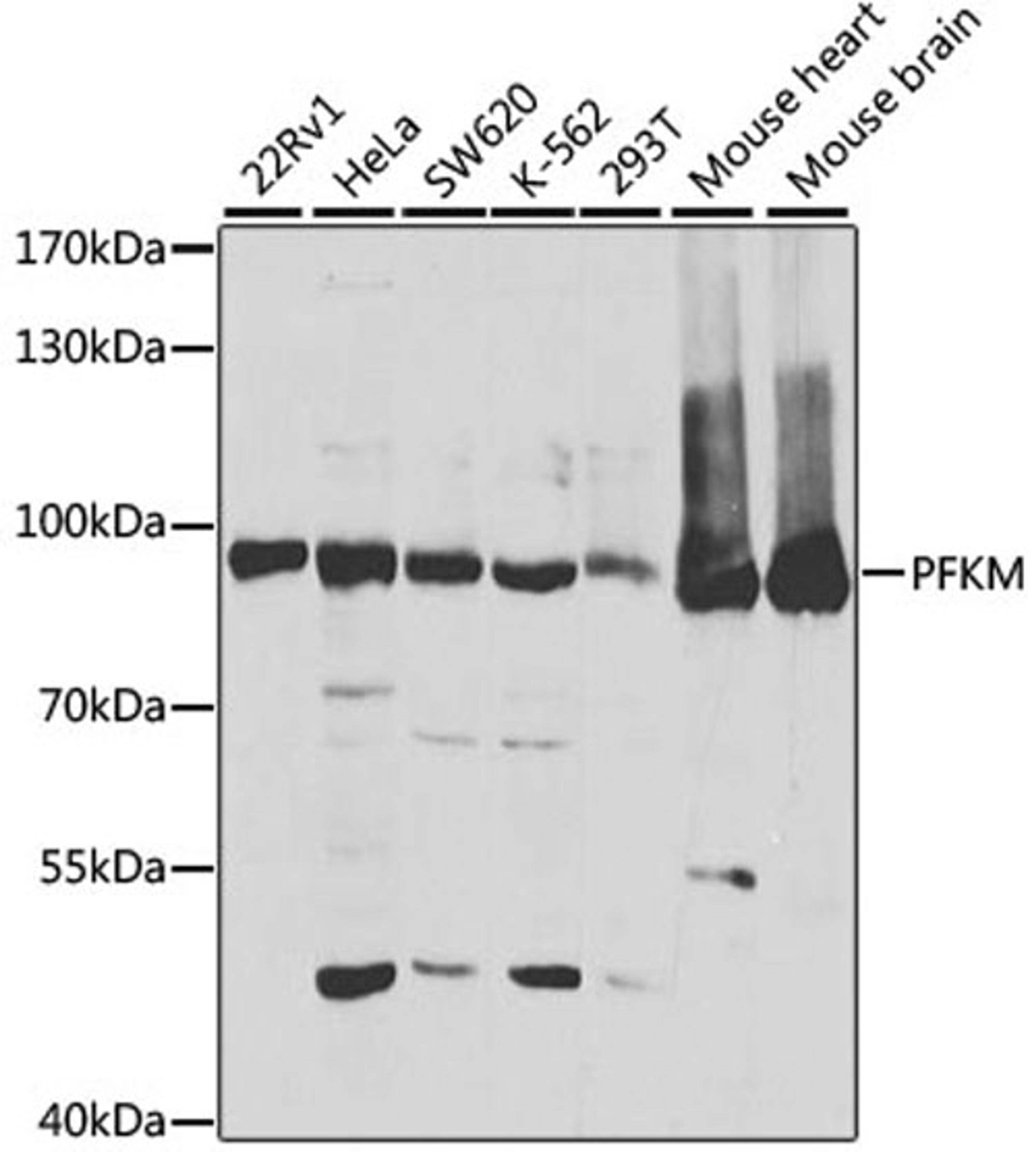 Western blot - PFKM antibody (A5477)