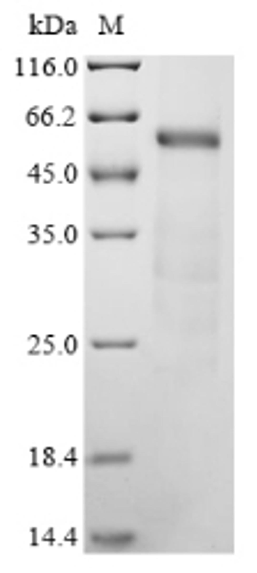 (Tris-Glycine gel) Discontinuous SDS-PAGE (reduced) with 5% enrichment gel and 15% separation gel.