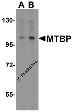 Western blot analysis of MTBP expression in K562 cell lysate with MTBP antibody at (A) 1 and (B) 2 μg/ml.
