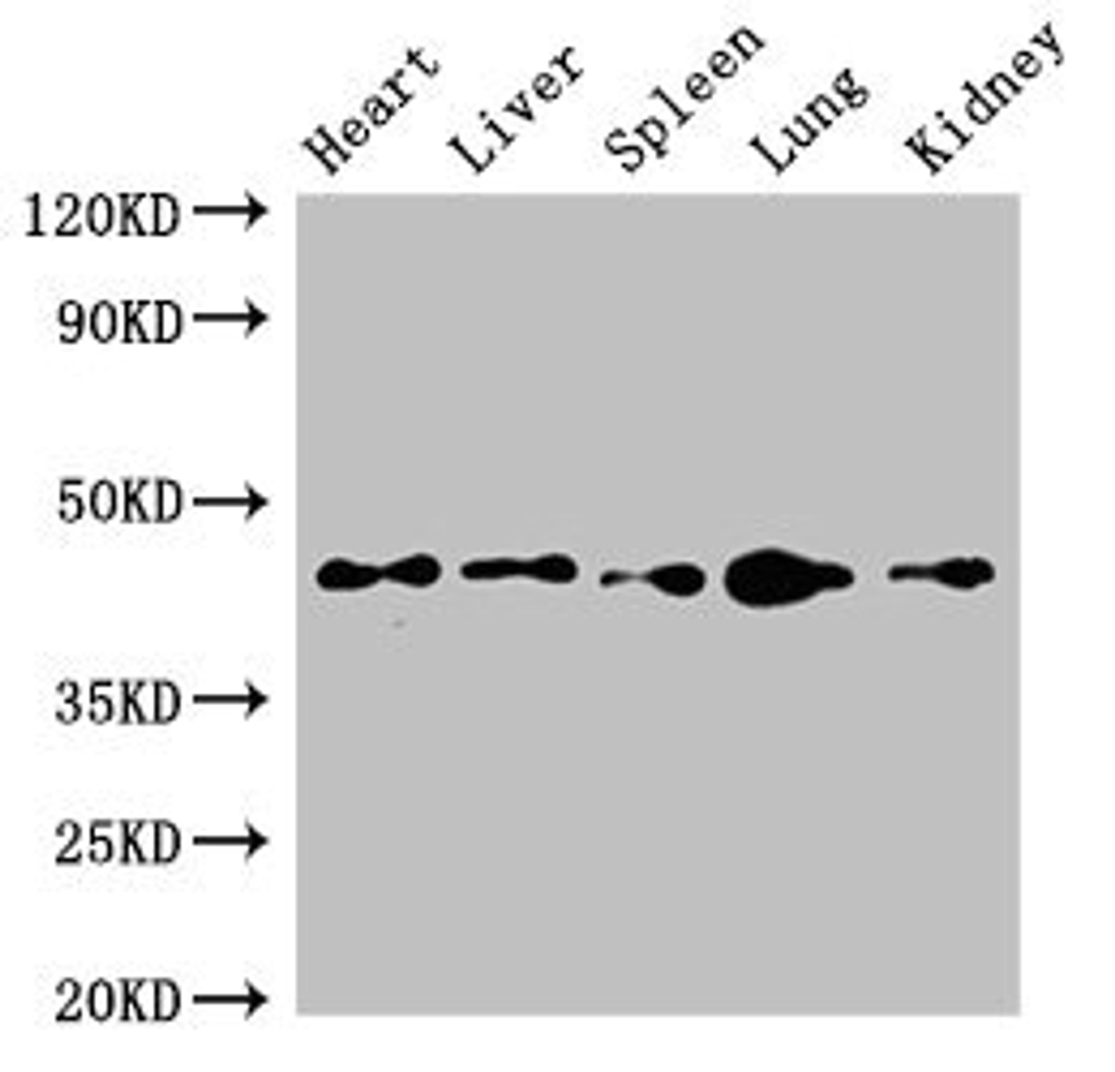 Western Blot. Positive WB detected in: Mouse heart tissue, Mouse liver tissue, Mouse spleen tissue, Mouse lung tissue, Mouse kidney tissue. All lanes: CD209 antibody at 4ug/ml. Secondary. Goat polyclonal to rabbit IgG at 1/50000 dilution. Predicted band size: 46, 36, 19, 44, 42, 31, 5, 38, 34 kDa. Observed band size: 46 kDa. 