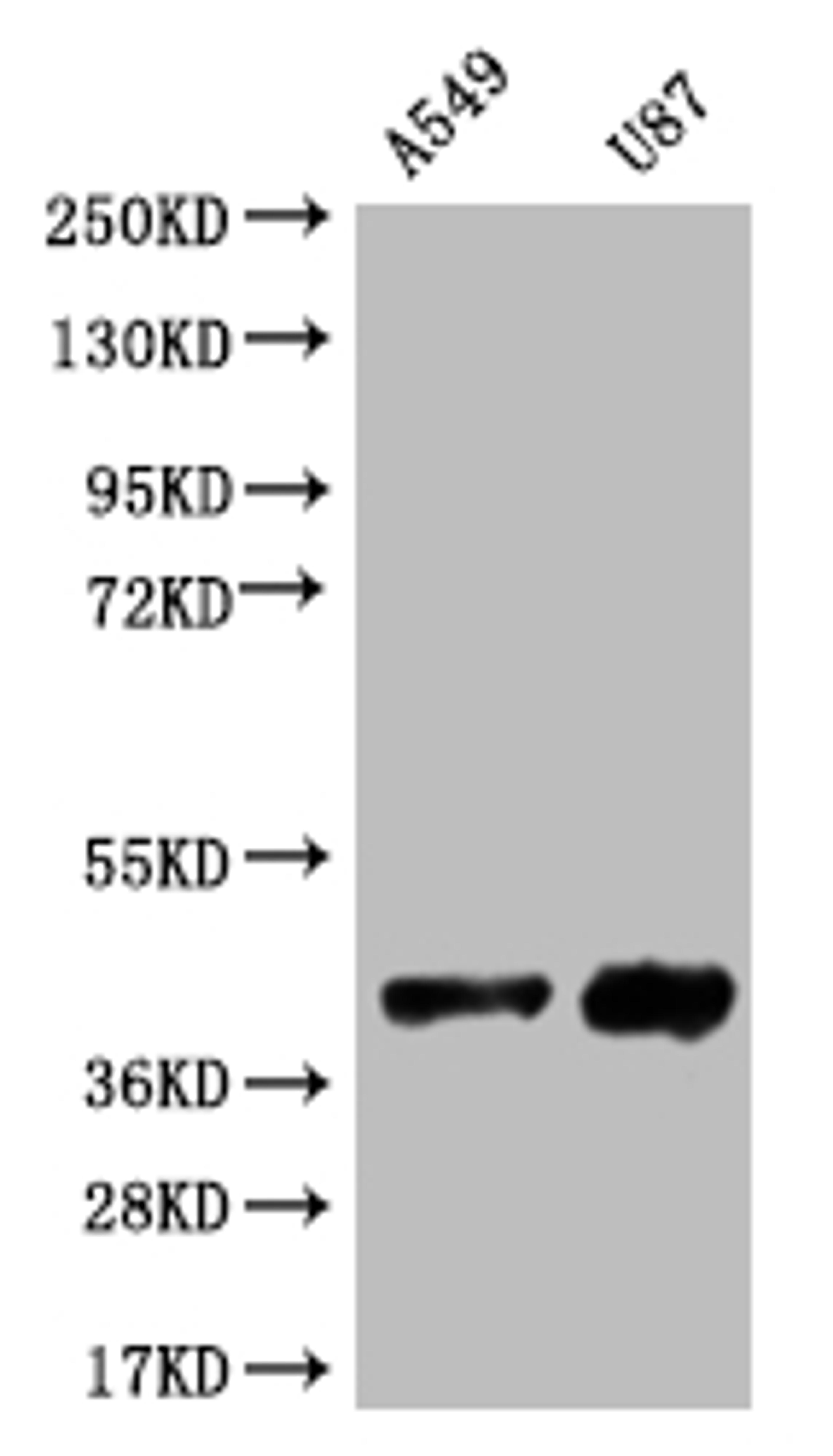 Western Blot. Positive WB detected in: A549 whole cell lysate, U87 whole cell lysate. All lanes: SRR antibody at 1:1000. Secondary. Goat polyclonal to rabbit IgG at 1/50000 dilution. Predicted band size: 37 kDa. Observed band size: 37 kDa. 