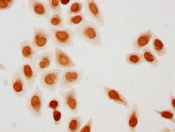 Immunocytochemistry analysis of CSB-PA010418PA79hibHU diluted at 1:10 and staining in Hela cells(treated with 30mM sodium butyrate for 4h) performed on a Leica BondTM system. The cells were fixed in 4% formaldehyde, permeabilized using 0.2% Triton X-100 and blocked with 10% normal goat serum 30min at RT. Then primary antibody (1% BSA) was incubated at 4°C overnight. The primary is detected by a biotinylated secondary antibody and visualized using an HRP conjugated SP system.