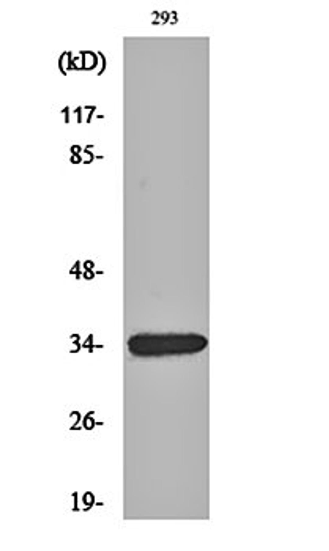 Western blot analysis of 293 cell lysates using GDF-15 antibody