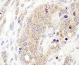 Detection of mouse CCT3 by immunohistochemistry.