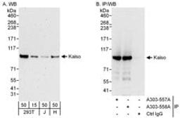 Detection of human Kaiso by western blot and immunoprecipitation.