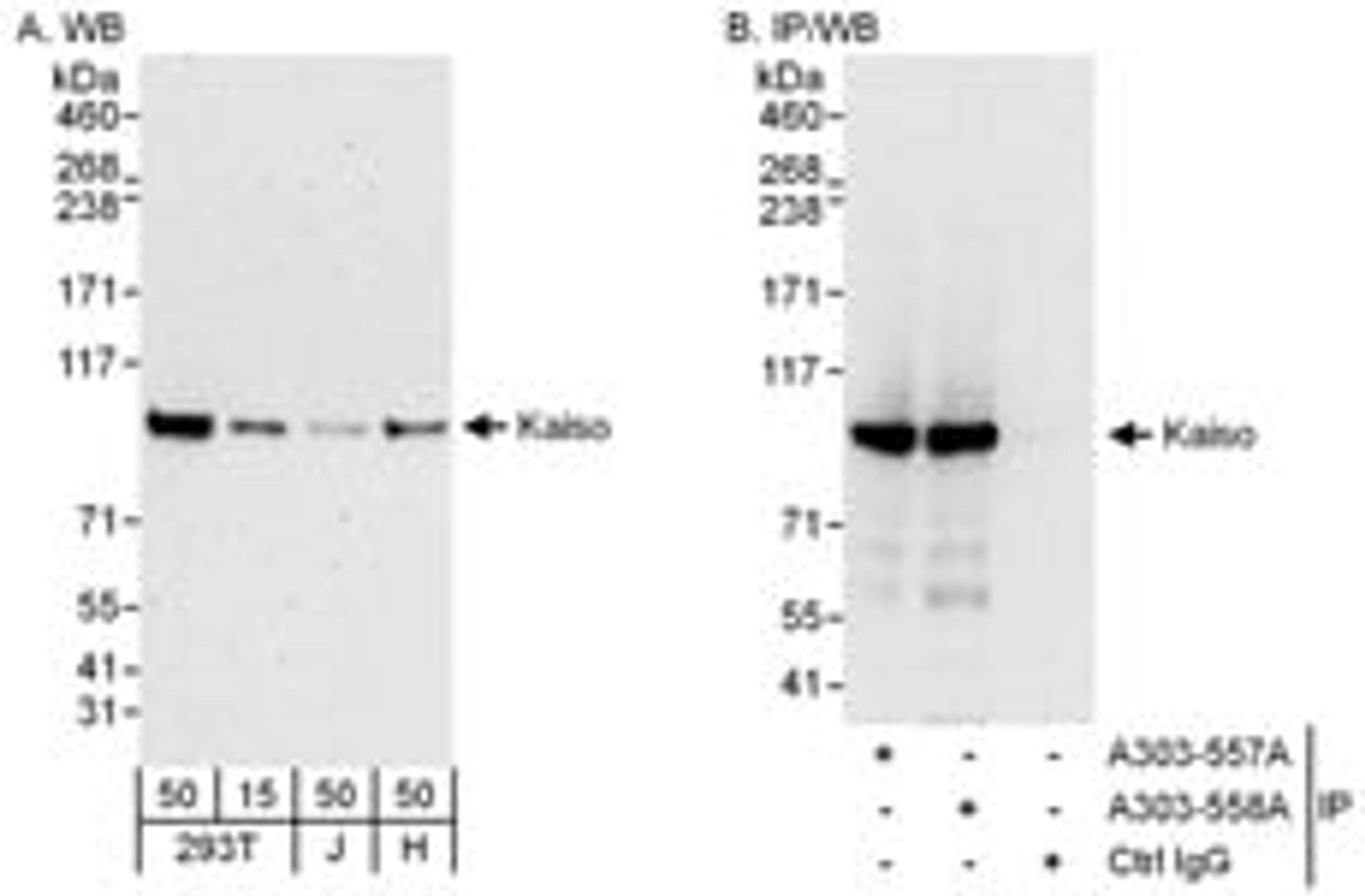 Detection of human Kaiso by western blot and immunoprecipitation.