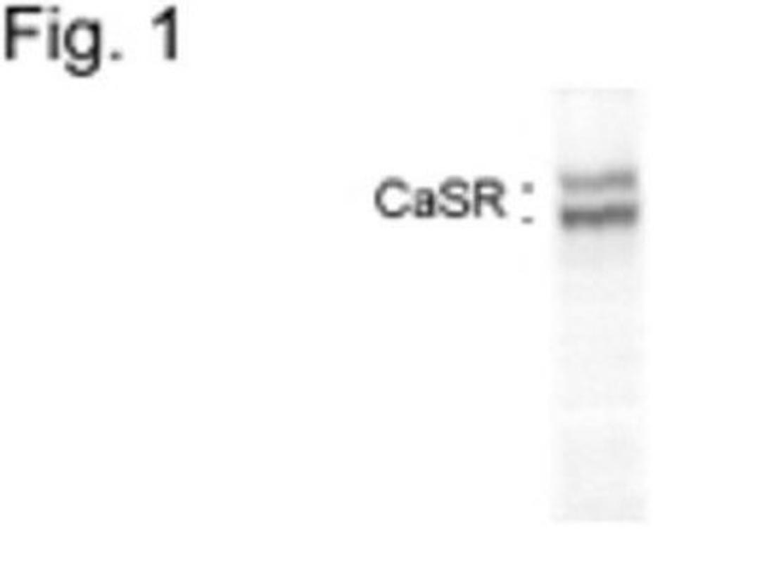 Western Blot: Calcium-sensing R/CaSR Antibody (5C10, ADD) [NB120-19347] - Analysis of calcium sensing receptor in HEK7-2 cell extract.