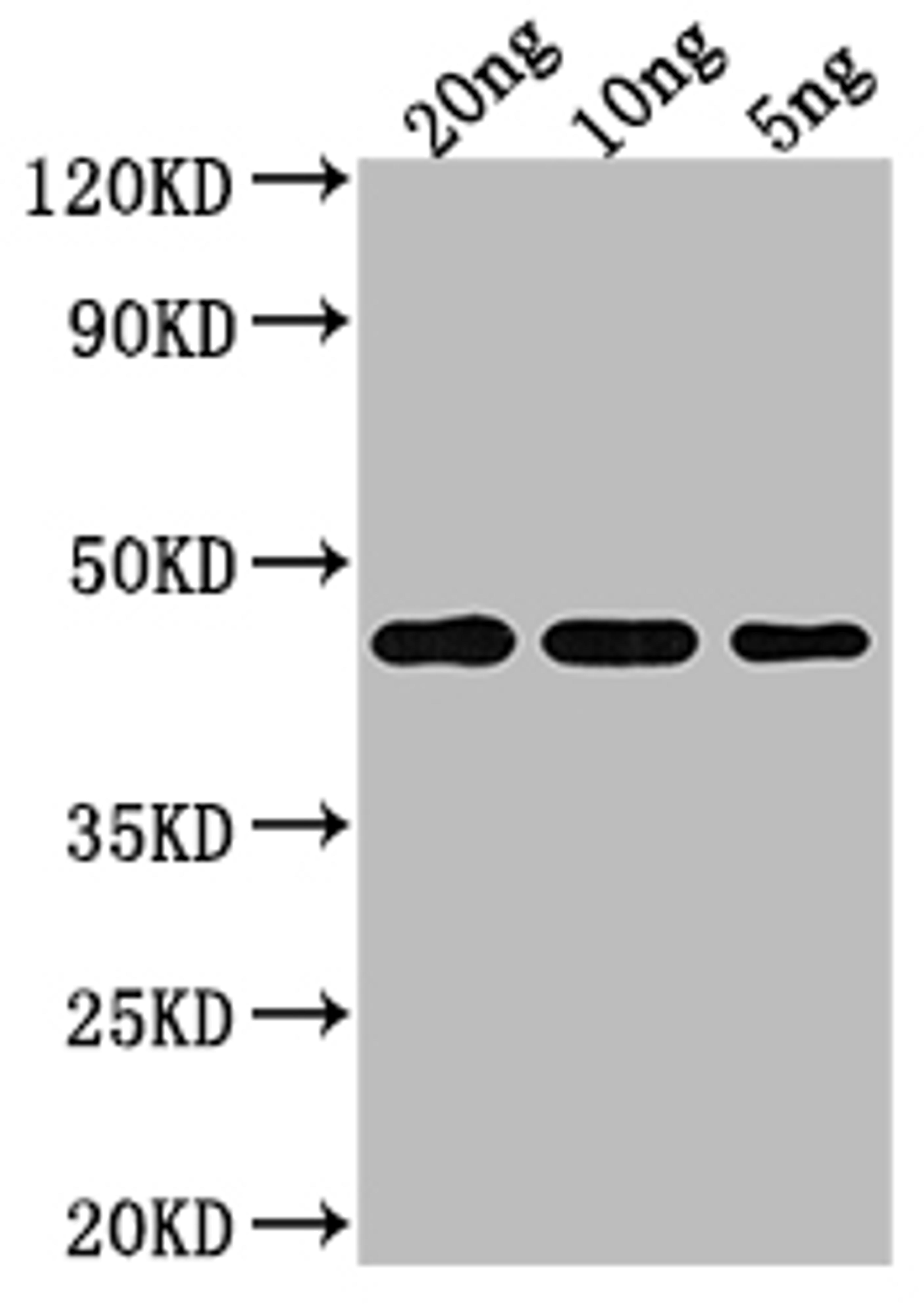 Western Blot. Positive WB detected in Recombinant protein. All lanes: TOXR antibody at 1:2000. Secondary. Goat polyclonal to rabbit IgG at 1/50000 dilution. Predicted band size: 44.21 kDa. Observed band size: 44 kDa. 