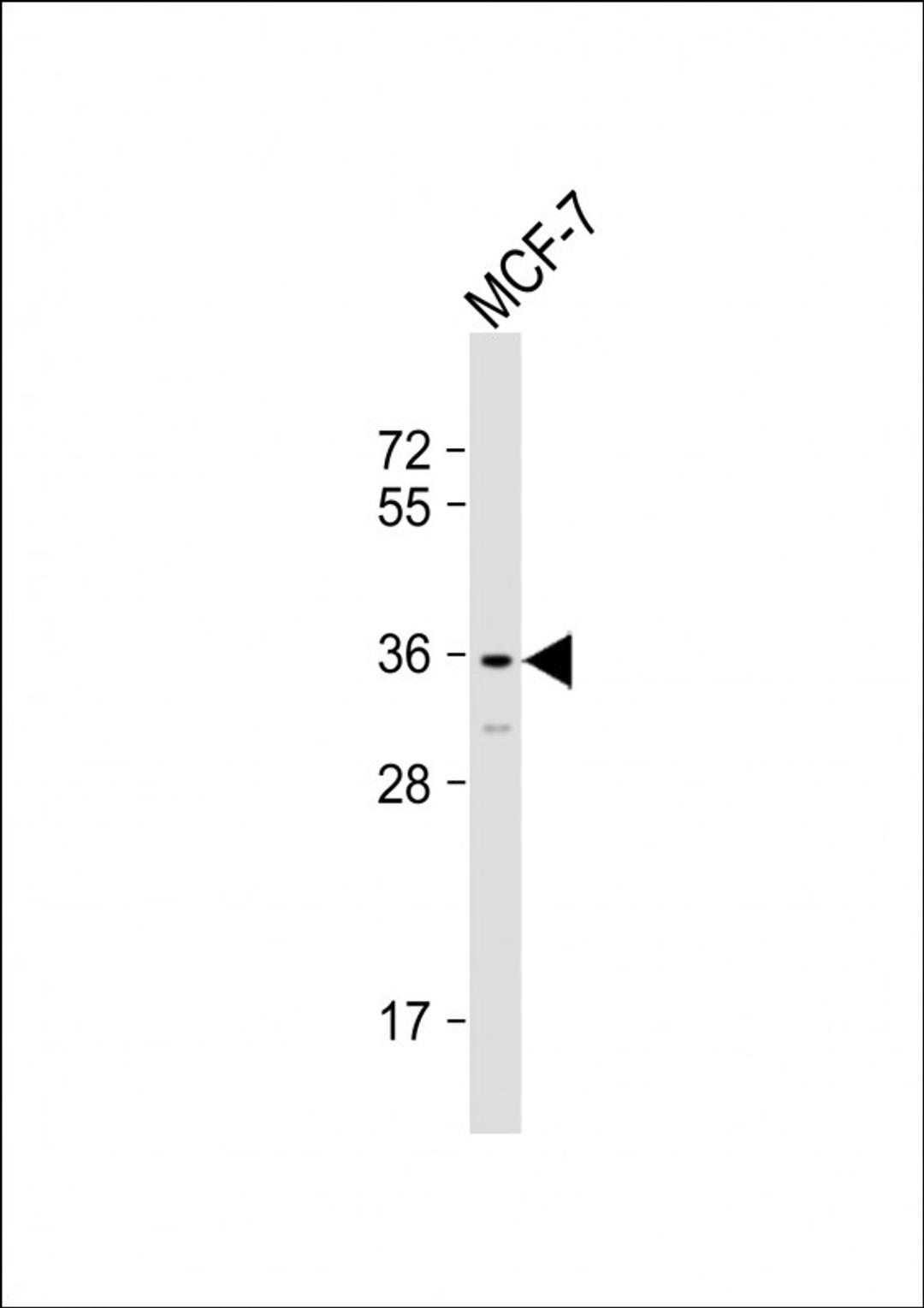 Western Blot at 1:1000 dilution + MCF-7 whole cell lysate Lysates/proteins at 20 ug per lane.