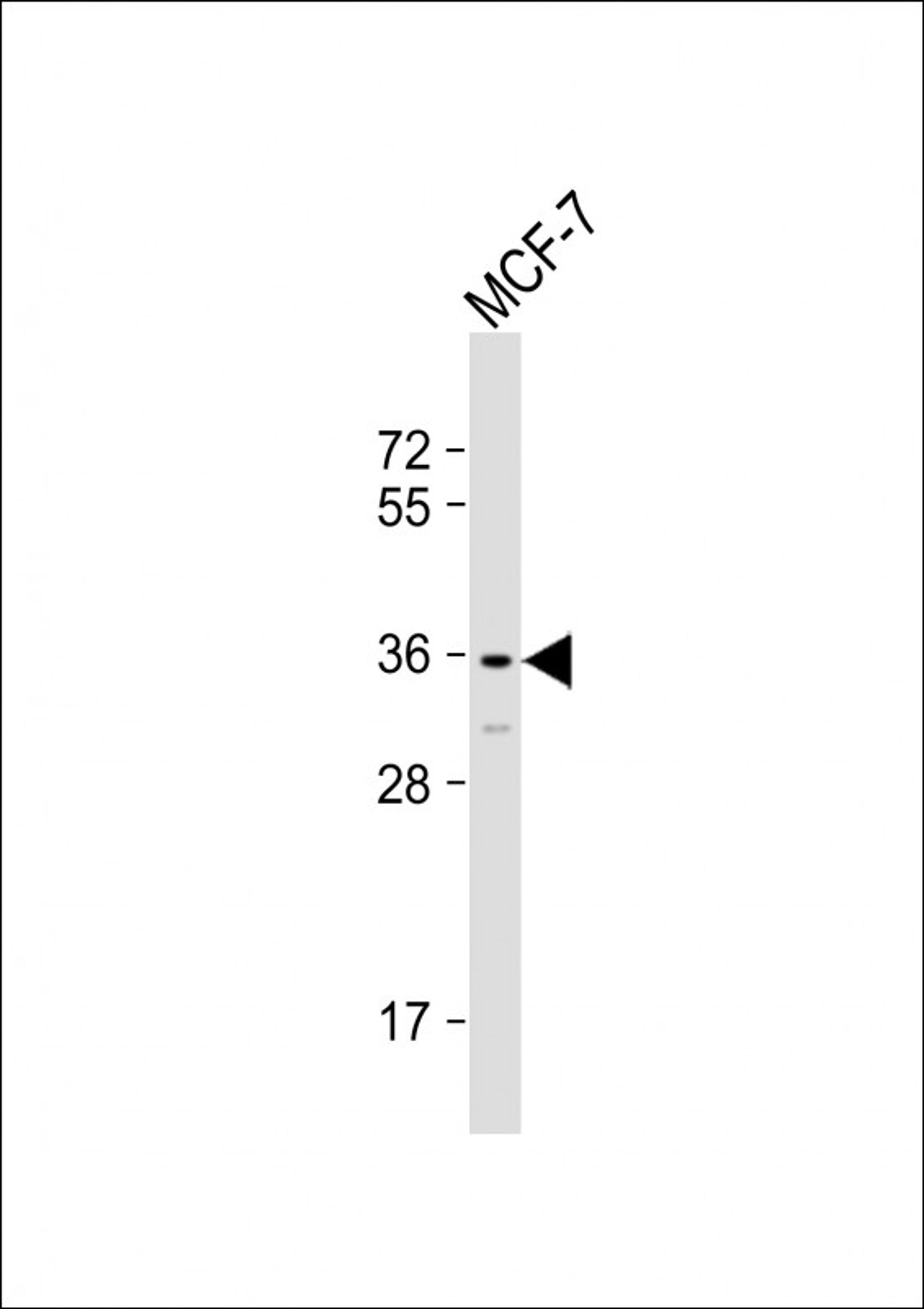 Western Blot at 1:1000 dilution + MCF-7 whole cell lysate Lysates/proteins at 20 ug per lane.