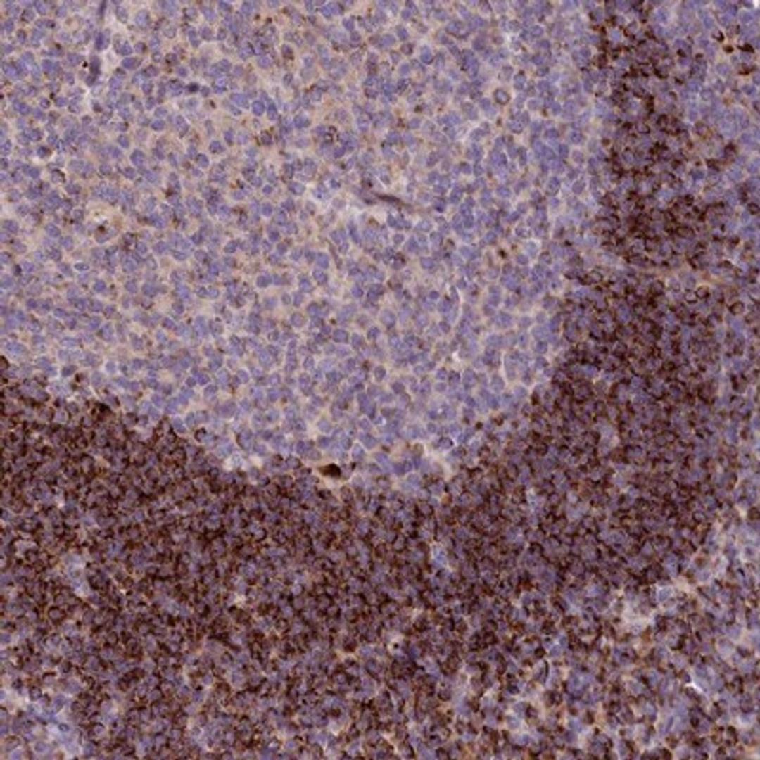 Immunohistochemistry-Paraffin: HLA DOA Antibody [NBP1-91993] - Staining of human tonsil shows strong granular cytoplasmic positivity in non-germinal center cells.