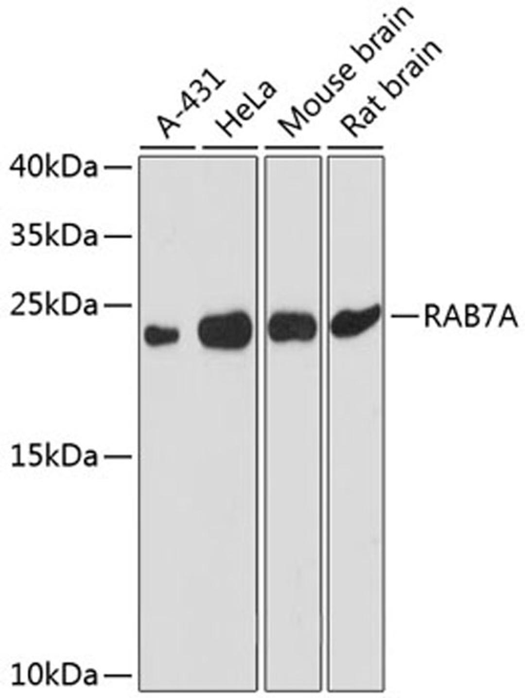 Western blot - RAB7A antibody (A12784)