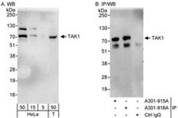 Detection of human TAK1 by western blot and immunoprecipitation.