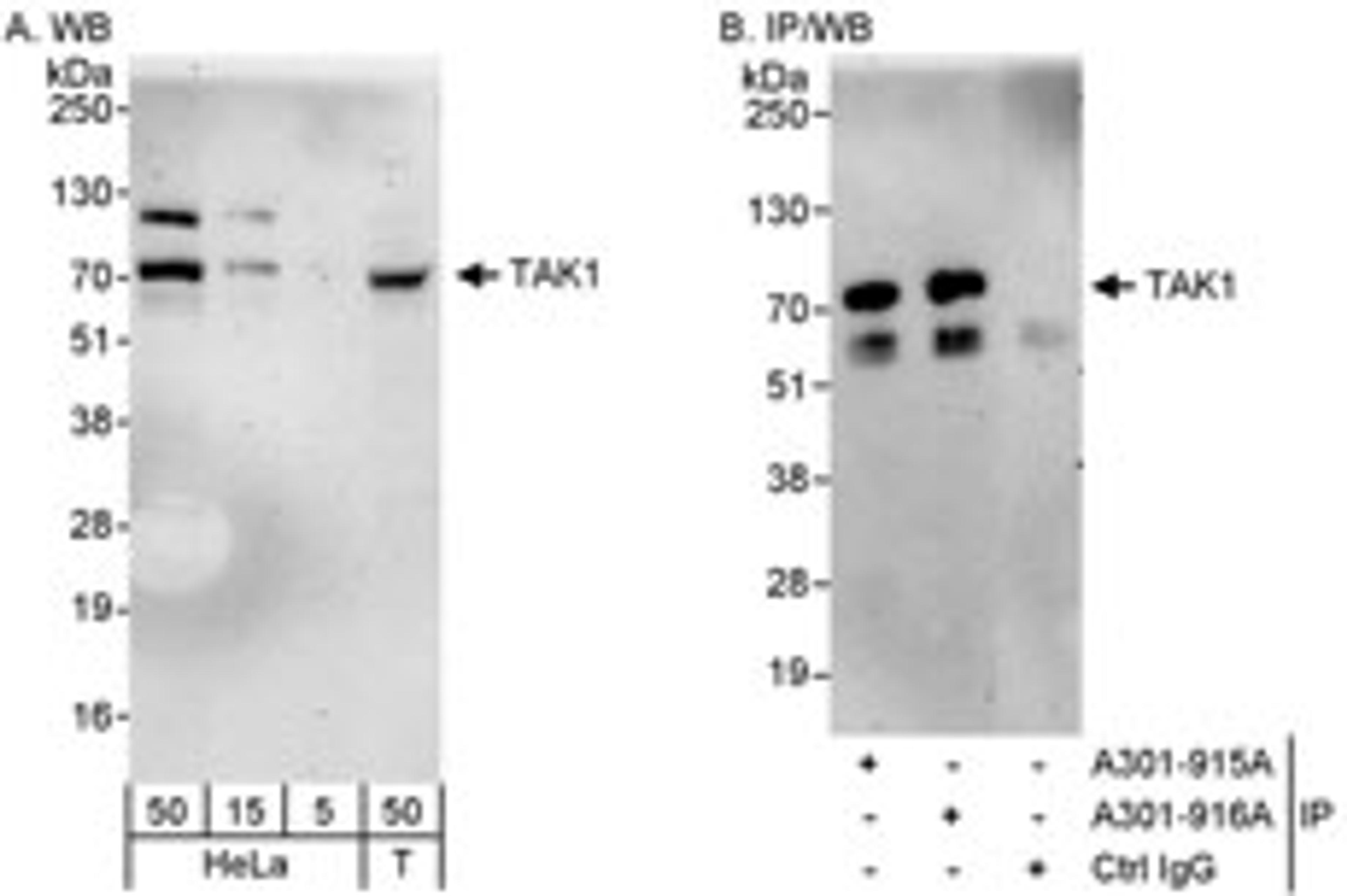 Detection of human TAK1 by western blot and immunoprecipitation.