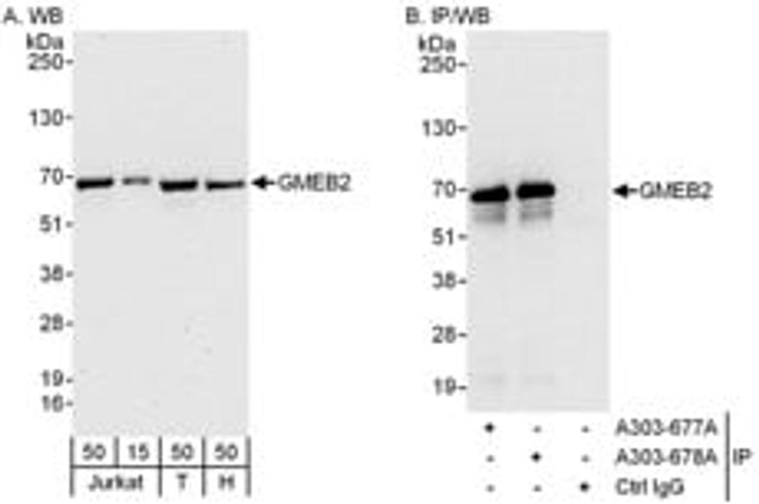 Detection of human GMEB2 by western blot and immunoprecipitation.