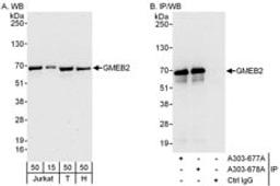 Detection of human GMEB2 by western blot and immunoprecipitation.