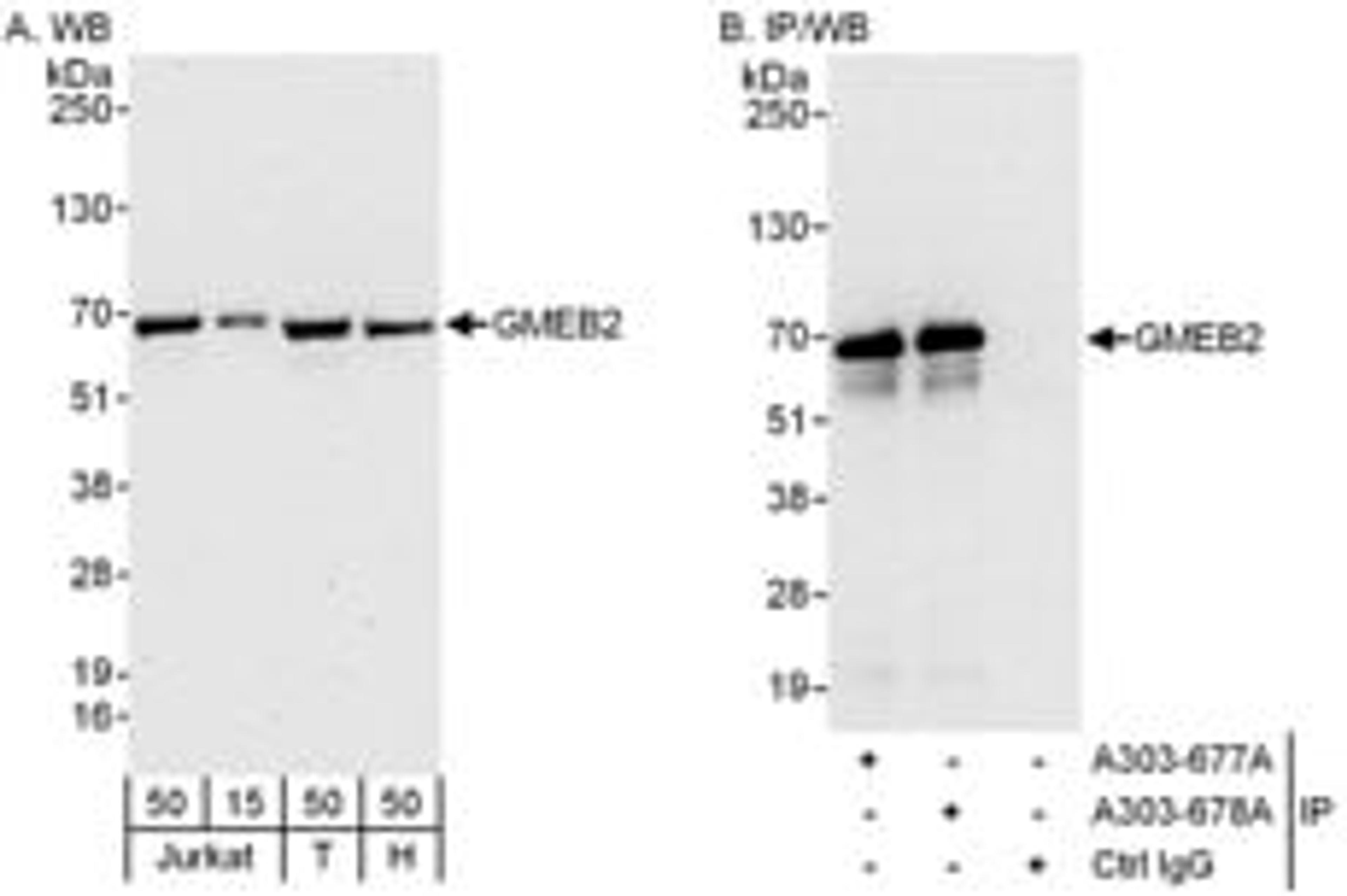 Detection of human GMEB2 by western blot and immunoprecipitation.