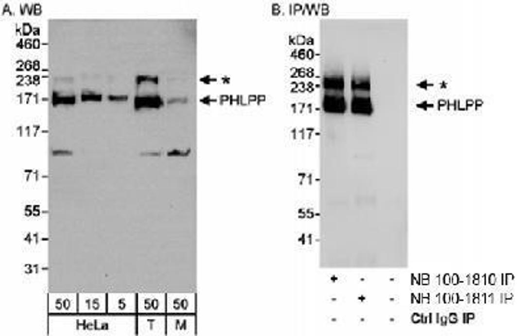 Western Blot: PHLPP Antibody [NB100-1811] - Detection of Human and Mouse PHLPP on HeLa whole cell lysate using NB100-1811. PHLPP was also immunoprecipitated using rabbit anti-PHLPP antibody NB100-1810.