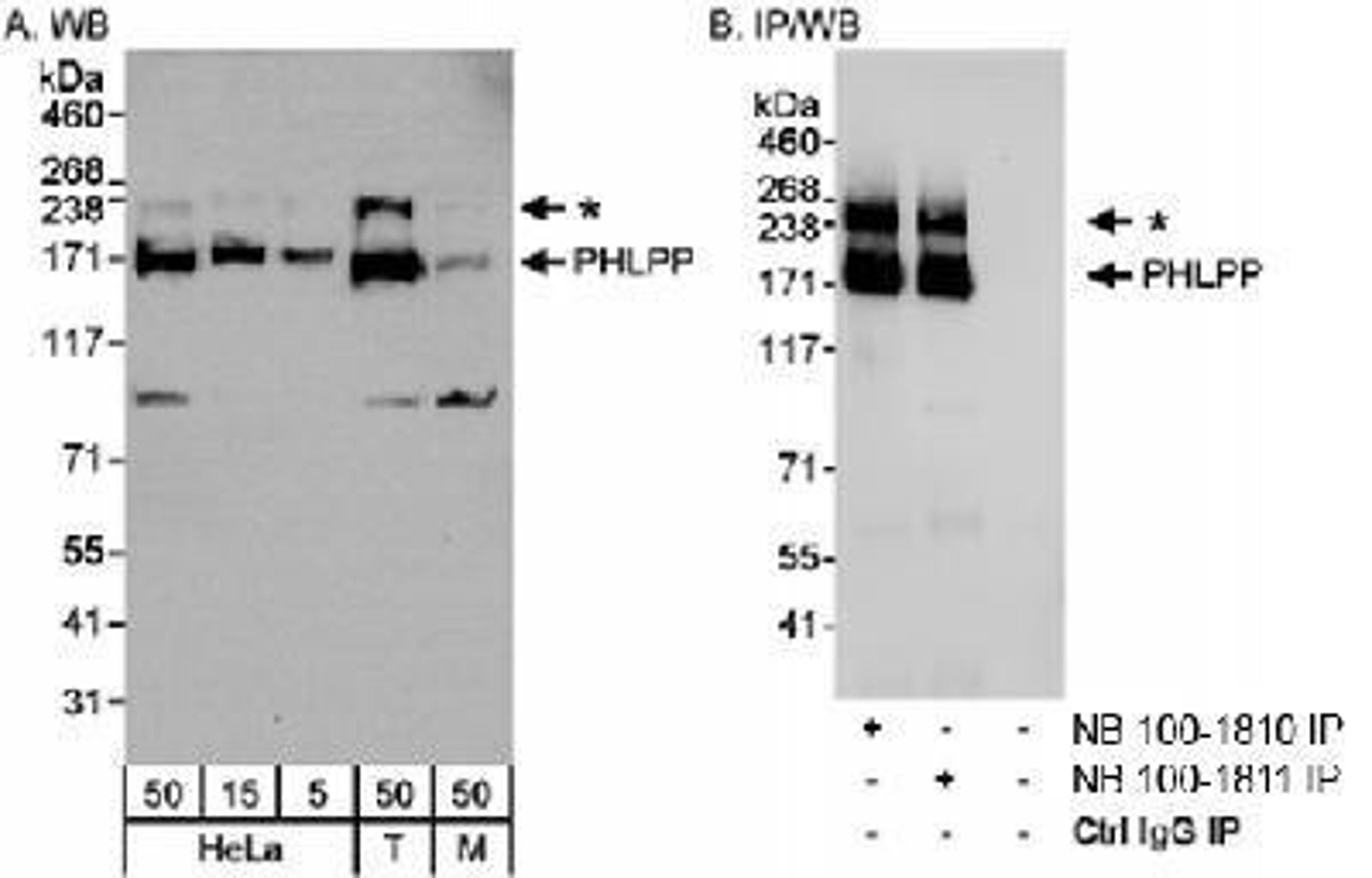 Western Blot: PHLPP Antibody [NB100-1811] - Detection of Human and Mouse PHLPP on HeLa whole cell lysate using NB100-1811. PHLPP was also immunoprecipitated using rabbit anti-PHLPP antibody NB100-1810.