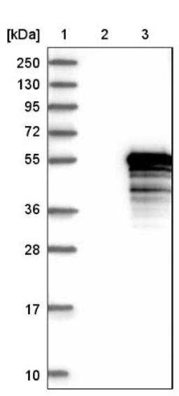 Western Blot: TEX9 Antibody [NBP1-86249] - Lane 1: Marker [kDa] 250, 130, 95, 72, 55, 36, 28, 17, 10<br/>Lane 2: Negative control (vector only transfected HEK293T lysate)<br/>Lane 3: Over-expression lysate (Co-expressed with a C-terminal myc-DDK tag (~3.1 kDa) in mammalian HEK293T cells, LY404907)