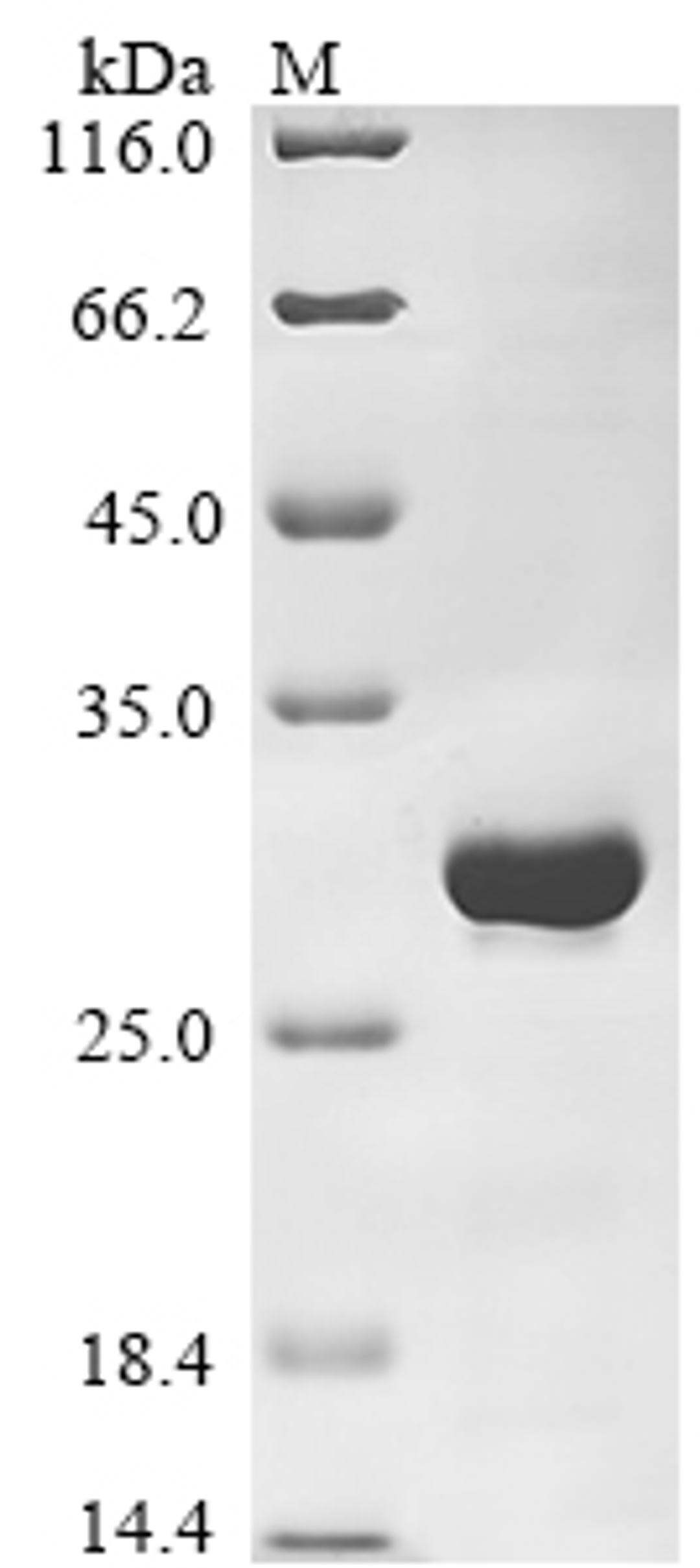 (Tris-Glycine gel) Discontinuous SDS-PAGE (reduced) with 5% enrichment gel and 15% separation gel.