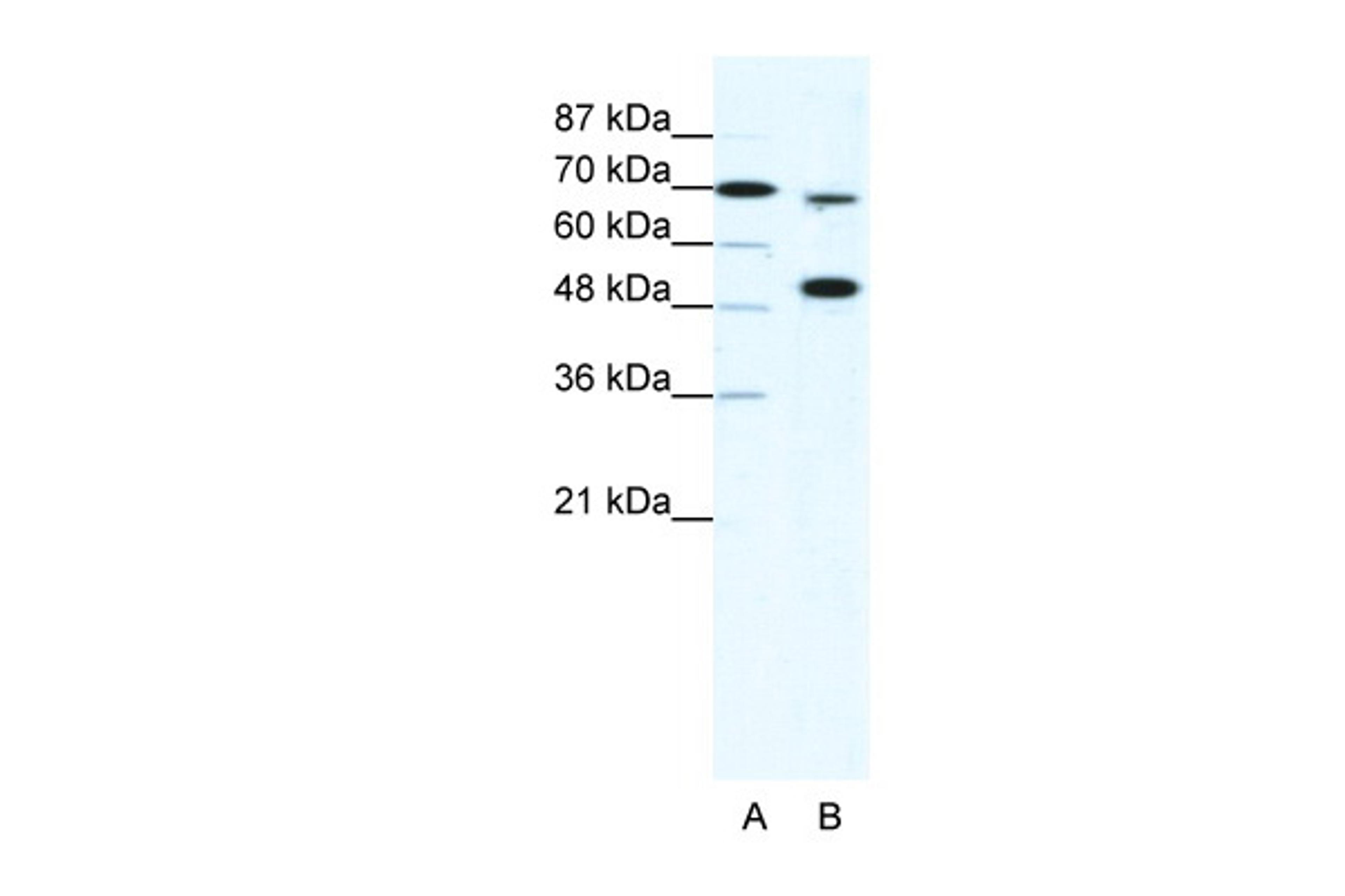 Antibody used in WB on Human HepG2 cells at 5 ug/ml.