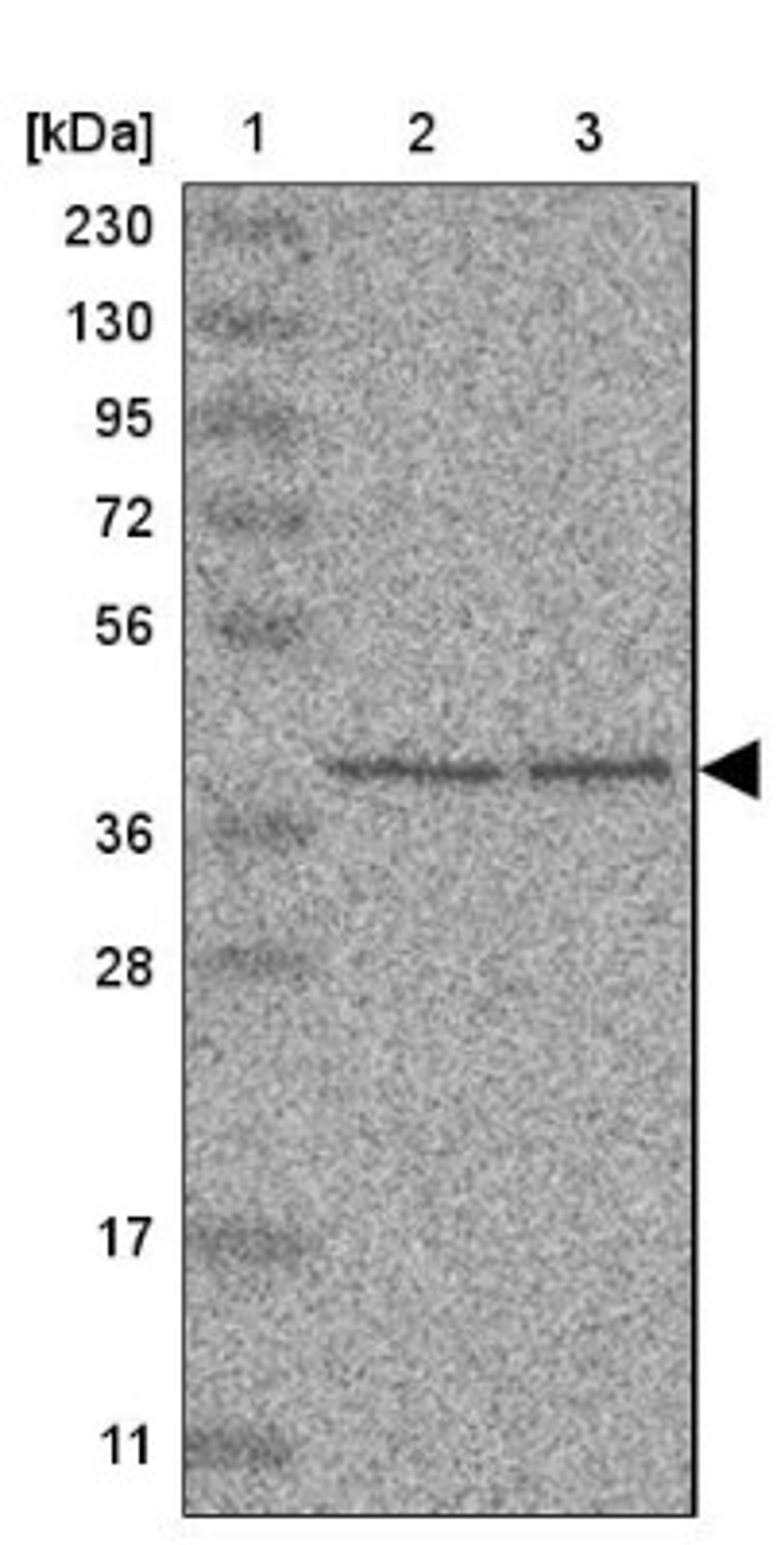 Western Blot: UROD Antibody [NBP1-89513] - Lane 1: Marker [kDa] 230, 130, 95, 72, 56, 36, 28, 17, 11<br/>Lane 2: Human cell line RT-4<br/>Lane 3: Human cell line U-251MG sp