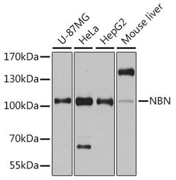 Western blot - NBN antibody (A0783)