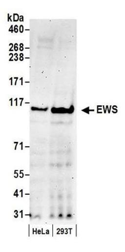 Detection of human EWS by western blot.