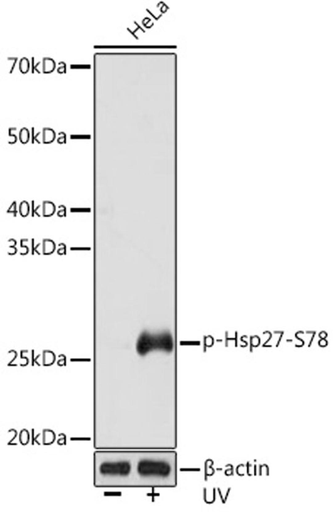 Western blot - Phospho-Hsp27-S78 Rabbit mAb (AP1032)