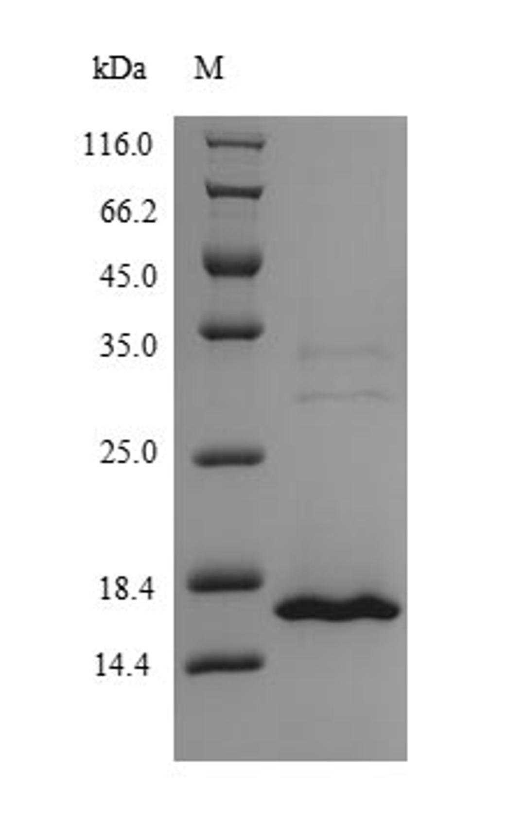 (Tris-Glycine gel) Discontinuous SDS-PAGE (reduced) with 5% enrichment gel and 15% separation gel.