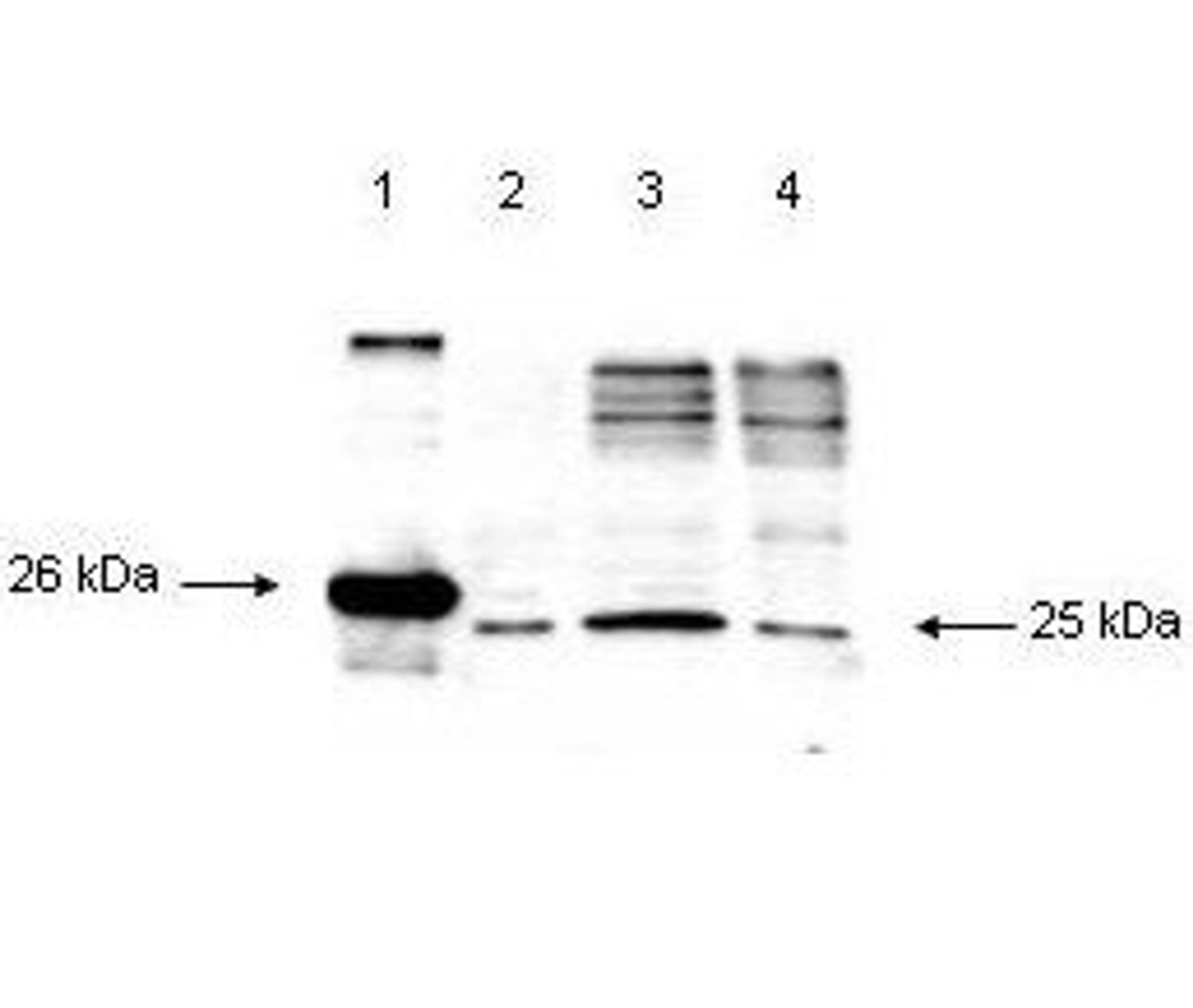 Western blot analysis of NP-40 treated cell lysate from HeLa cells using Smac/Diablo antibody