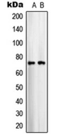 Western blot analysis of COLO205 (Lane 1), U251MG (Lane 2) whole cell lysates using SLC25A12 antibody