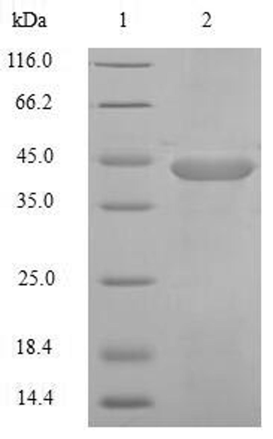 (Tris-Glycine gel) Discontinuous SDS-PAGE (reduced) with 5% enrichment gel and 15% separation gel.