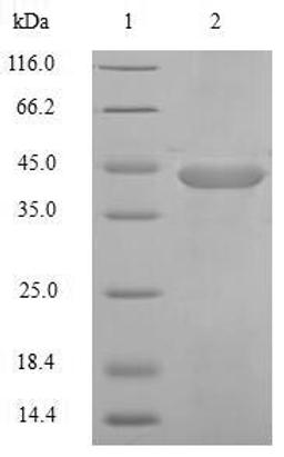 (Tris-Glycine gel) Discontinuous SDS-PAGE (reduced) with 5% enrichment gel and 15% separation gel.