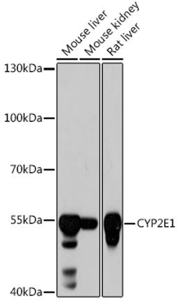 Western blot - CYP2E1 antibody (A2160)