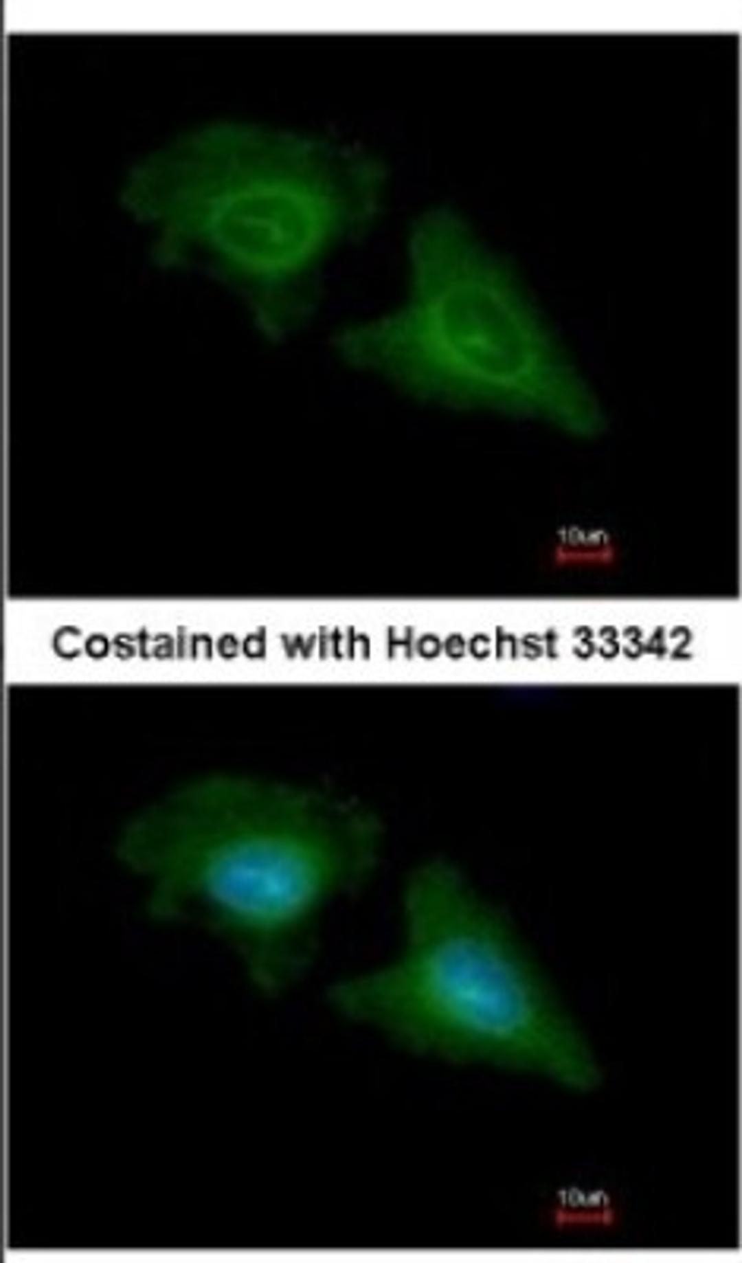 Immunocytochemistry/Immunofluorescence: GNB1 Antibody [NBP2-16699] - Immunofluorescence analysis of methanol-fixed HeLa, using antibody at 1:200 dilution.