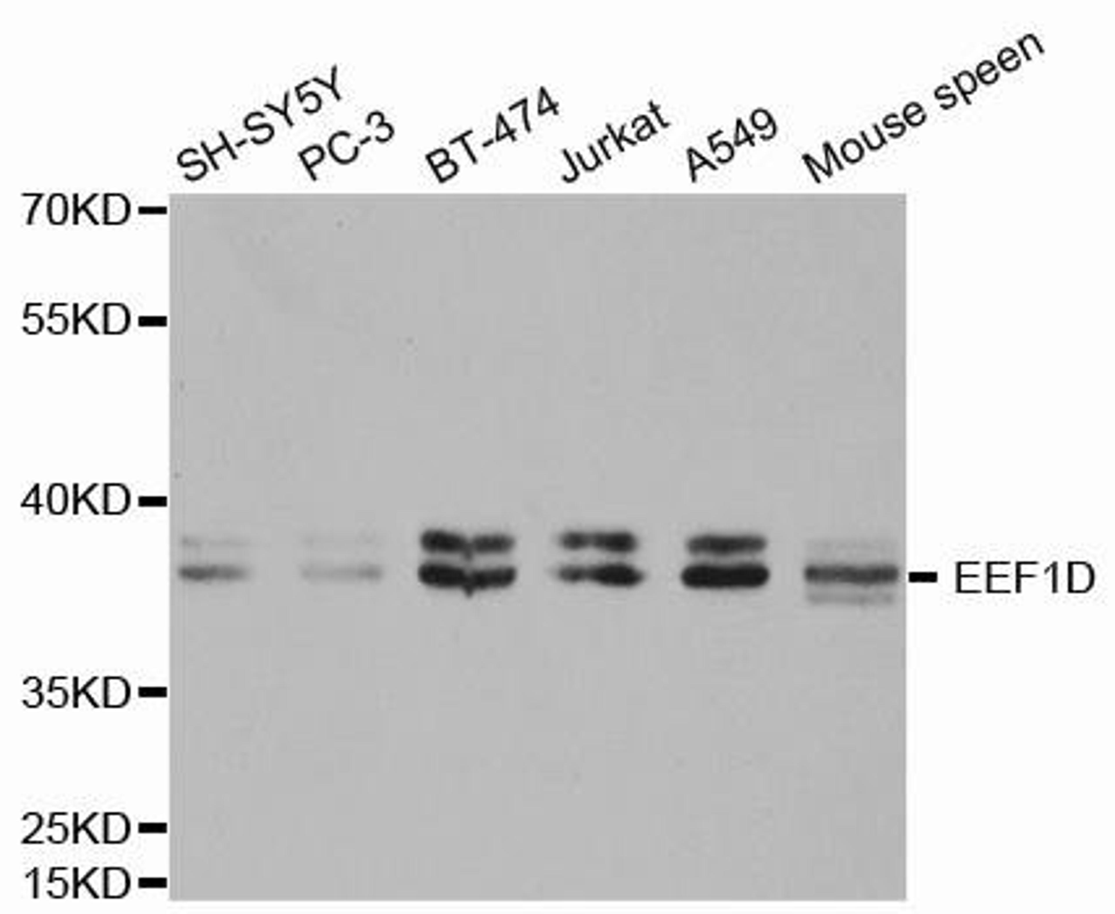 Western blot analysis of extracts of various cell lines using EEF1D antibody