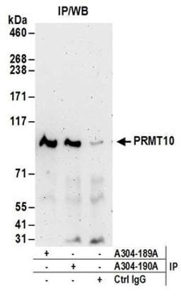 Detection of human PRMT10 by western blot of immunoprecipitates.