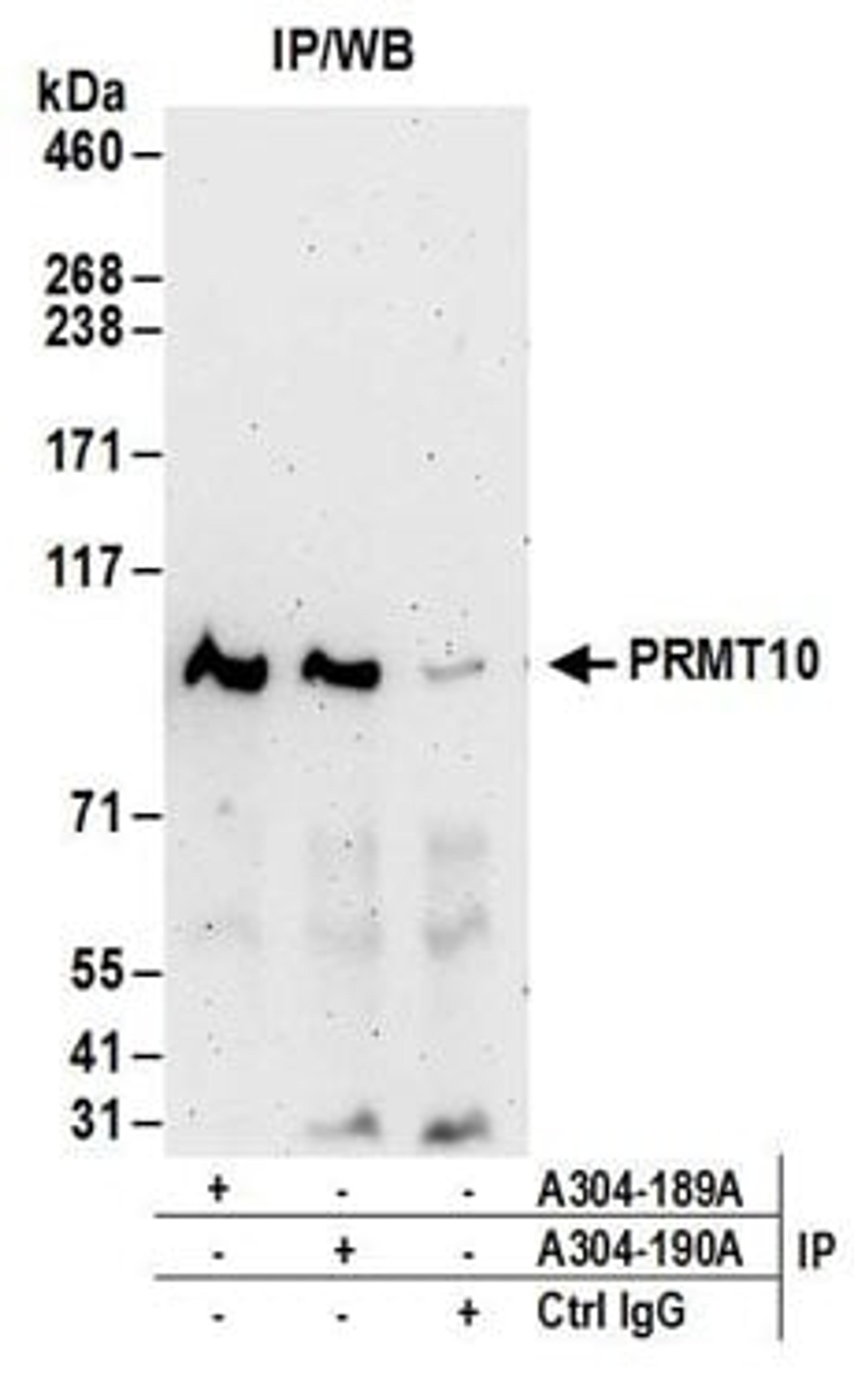 Detection of human PRMT10 by western blot of immunoprecipitates.