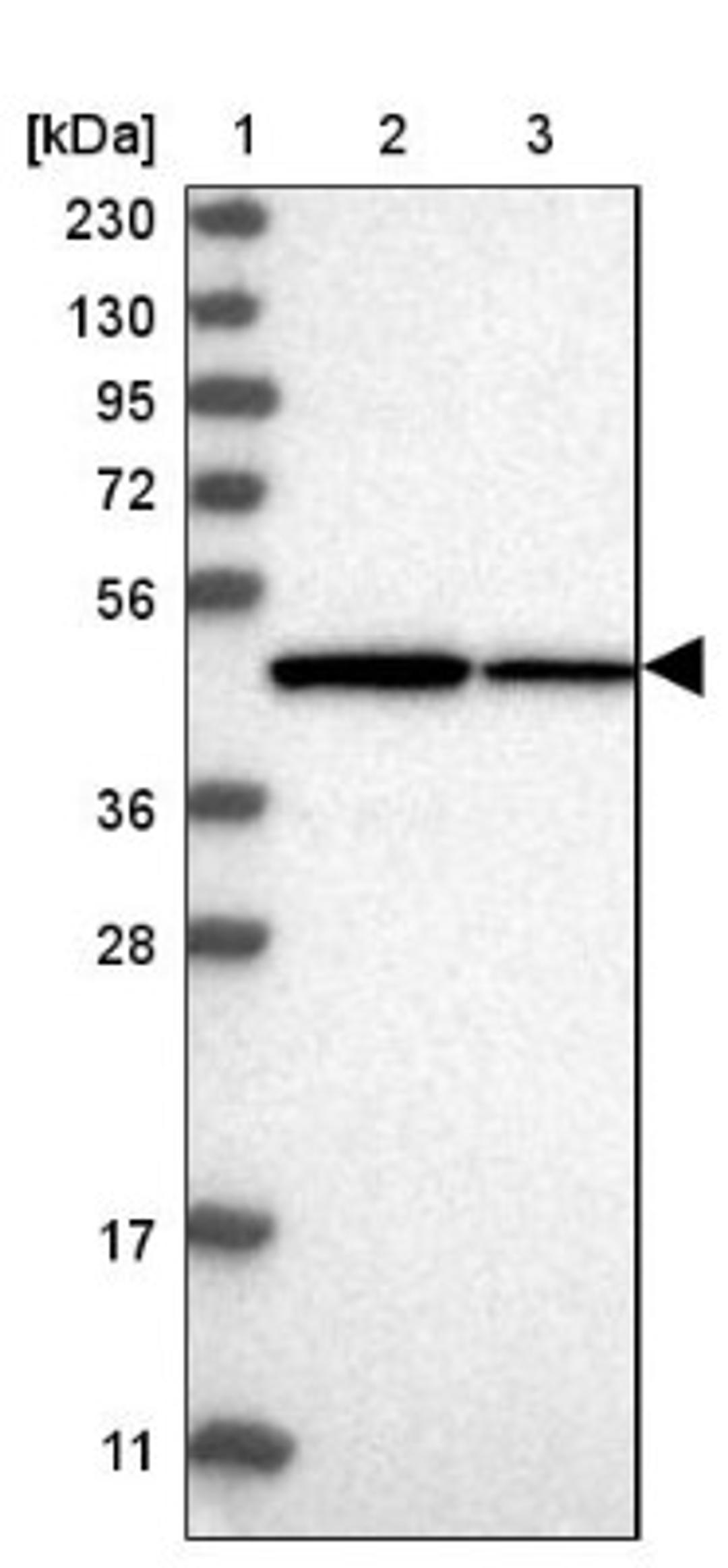 Western Blot: TRMT12 Antibody [NBP1-83633] - Lane 1: Marker [kDa] 230, 130, 95, 72, 56, 36, 28, 17, 11<br/>Lane 2: Human cell line RT-4<br/>Lane 3: Human cell line U-251MG sp