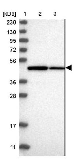 Western Blot: TRMT12 Antibody [NBP1-83633] - Lane 1: Marker [kDa] 230, 130, 95, 72, 56, 36, 28, 17, 11<br/>Lane 2: Human cell line RT-4<br/>Lane 3: Human cell line U-251MG sp