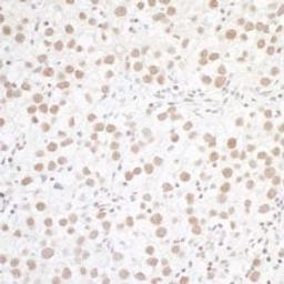 Detection of human WTAP by immunohistochemistry.