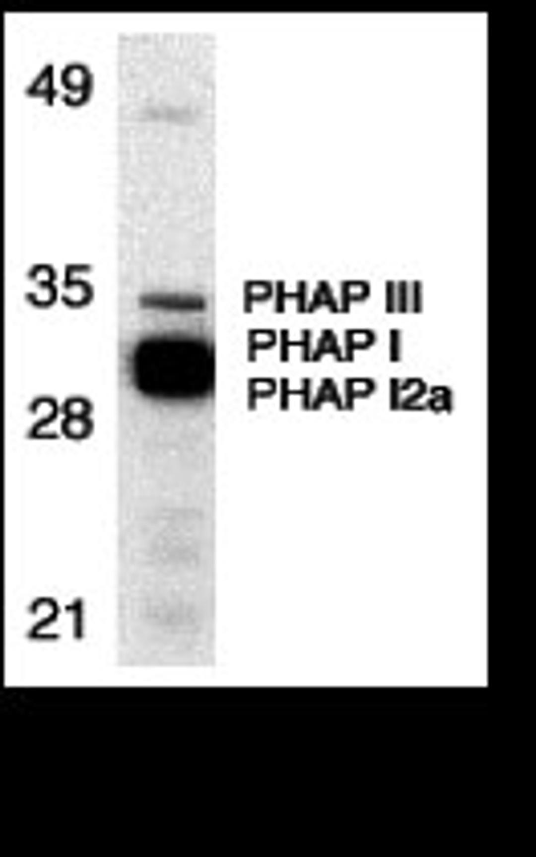 Western blot analysis of PHAP expression in human Raji cell lysate with PHAP antibody at 1 μg/mL. The wide and strong band below PHAP III is a doublelet composed of PHAP I (upper) and PHAP I2a (lower).